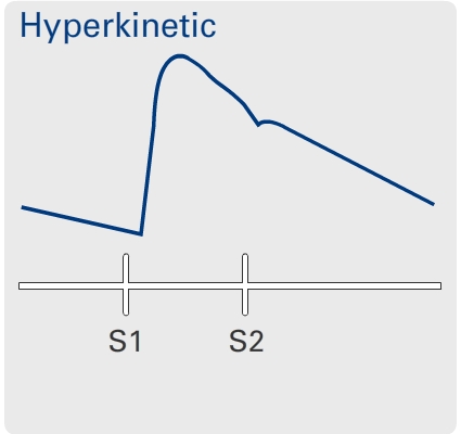 Hyperkinetic