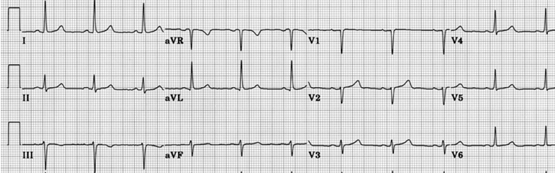 Essential Electrocardiography