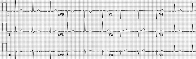 Essential Electrocardiography