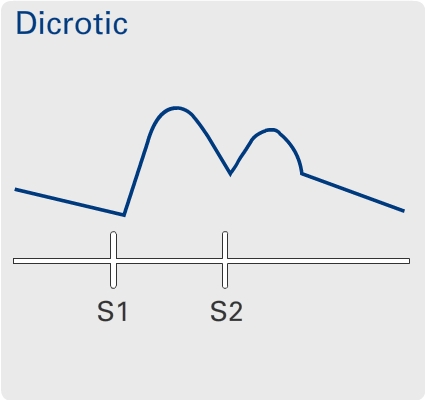 Dicrotic