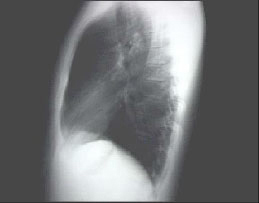 Lat Xray