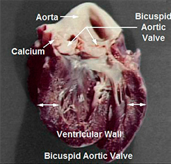 Pathology Specimen