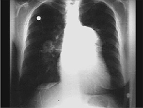 pa xray